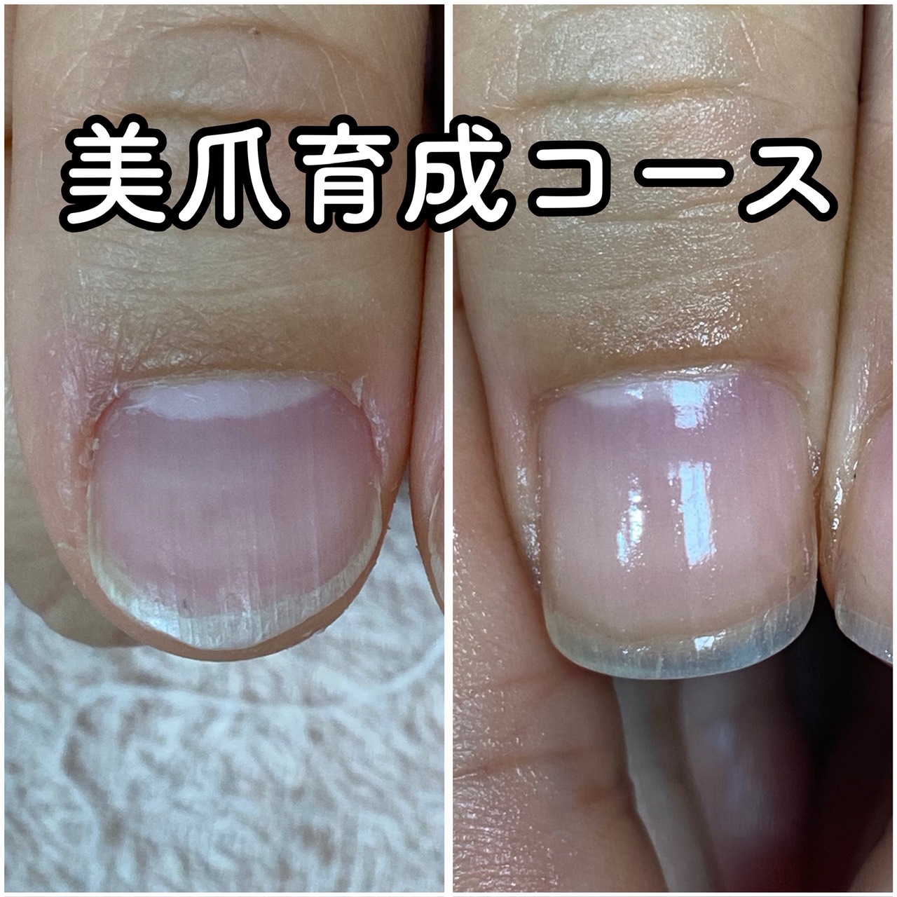 フィルインのメリット